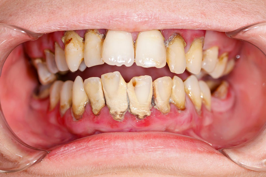 Most Usual Dental Problems That Adults Face on Regular Basis