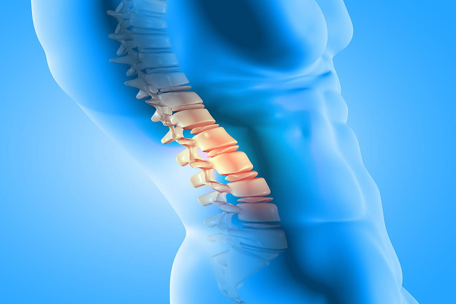 Degenerative Disc Disease