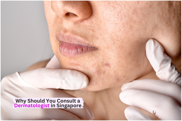Why Should You Consult Dermatologists in Singapore?