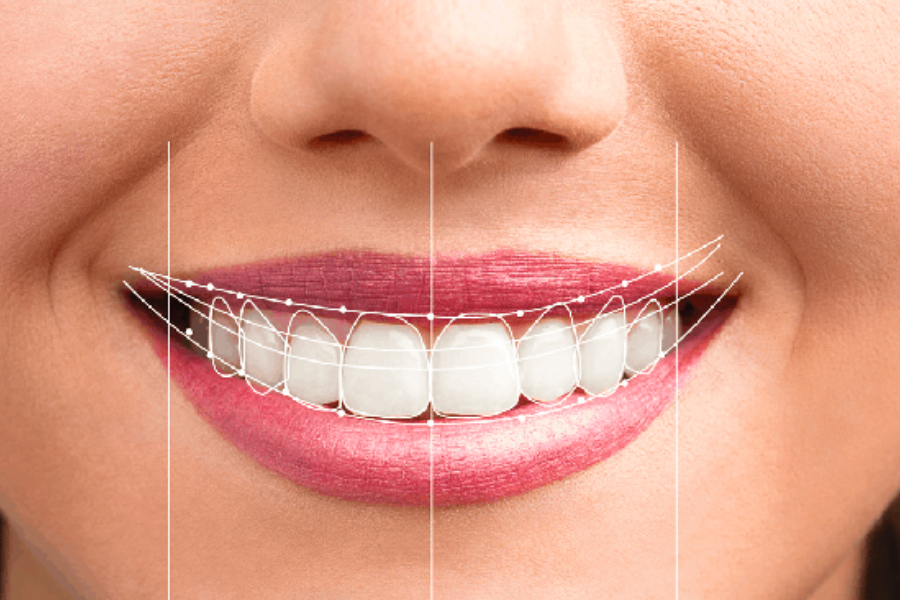 Smile Transformation Identifying Ideal Candidates For Braces And Orthodontic Treatment