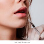 Why Are Lip Fillers Becoming Trendy Among Young People