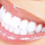 Is Soda Baking Good Teeth Whitening Method