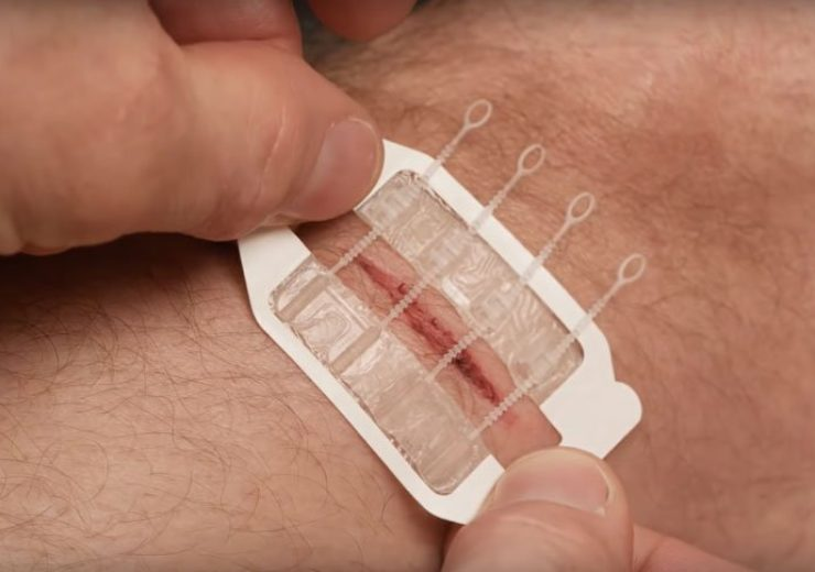 Innovation in Healing: The Impact of New Wound Closure Devices