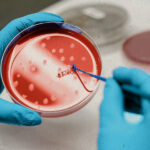 StemCellCures International Patient Care From Consultation to Recovery