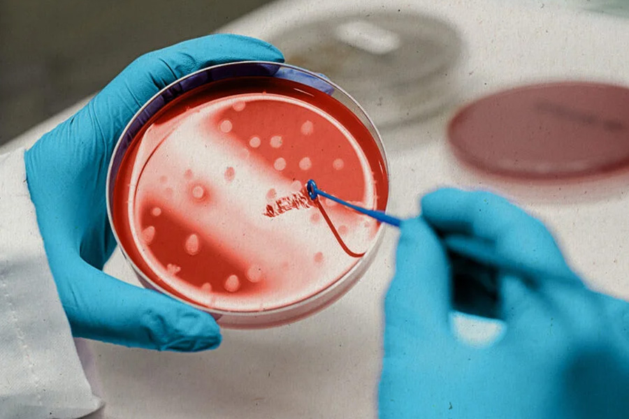 StemCellCure’s International Patient Care – From Consultation to Recovery